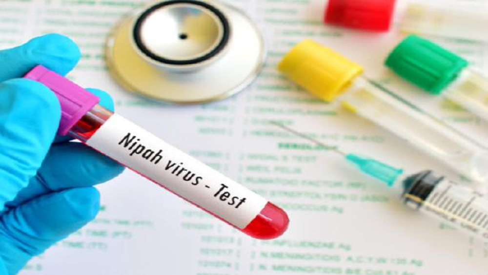 Minimal Chance Of Nipah Virus Spreading tTo Sri Lanka From India: Health Ministry
