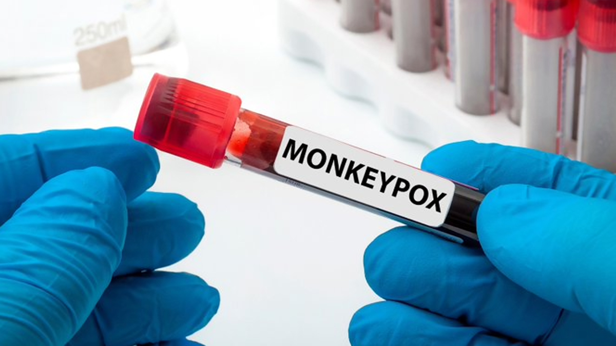 Mpox : Centre Issues Advisory for States, UTs to Create Awareness